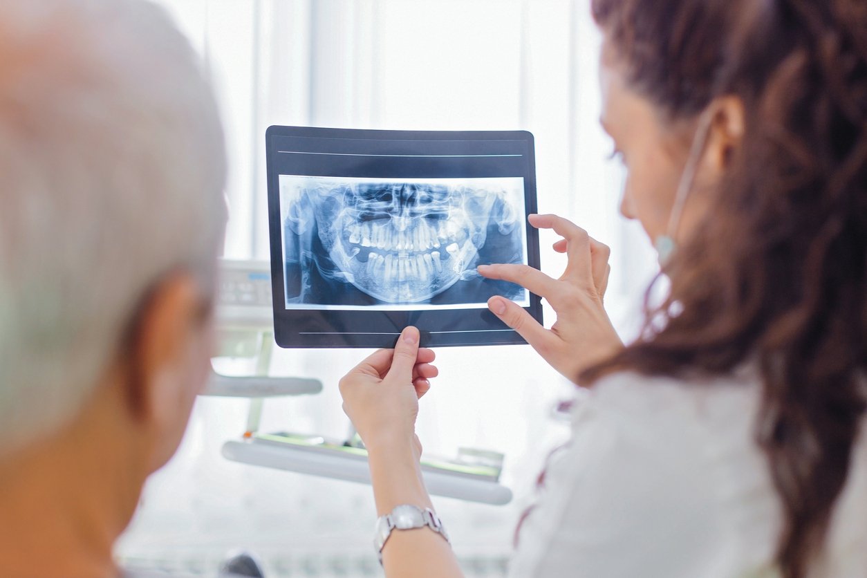 A dentist showing a dental X-ray to a patient in a treatment room.